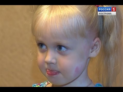 Видео: Арина Скоропекина, 4 года, мальформация кровеносных сосудов, требуется лечение