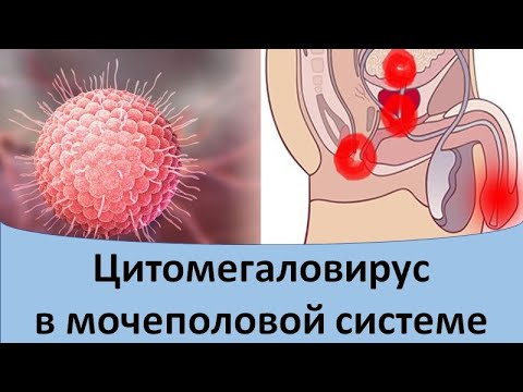 Видео: Цитомегаловирус в мочеполовой системе.