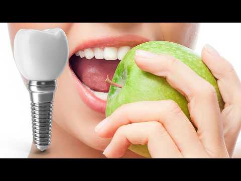 Видео: ИМПЛАНТАЦИЯ И Лечение зубов. Мой опыт. ОШИБКИ