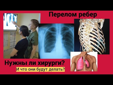 Видео: Перелом ребер. Нужны ли хирурги? И что они будут делать?