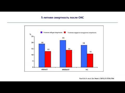 Видео: Острый коронарный синдром (часть 1): медико-социальное значение, патогенез, диагностика (2024)