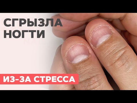Видео: Наращивание на ОБГРЫЗЕННЫЕ ногти | Как исправить?