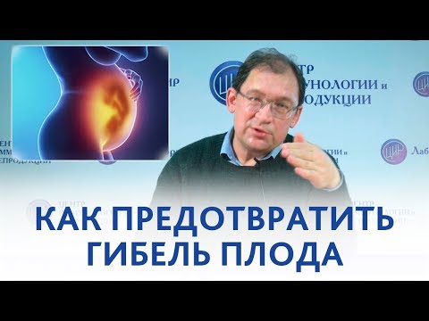 Видео: Гибель плода. Как избежать инфаркта плаценты и гибели плода.