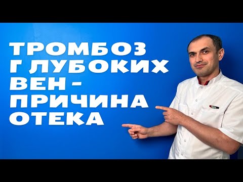 Видео: Как заподозрить тромбоз глубоких вен. Флеболог Москва.
