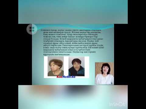 Видео: Тақырыбы: Гипотиреоз. Оқытушы: Конирова С.К.