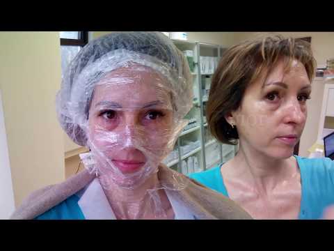 Видео: ЖЕЛТЫЙ ПИЛИНГ - процедура и шелушение день за днем | Golden Yellow Peel Dermatime