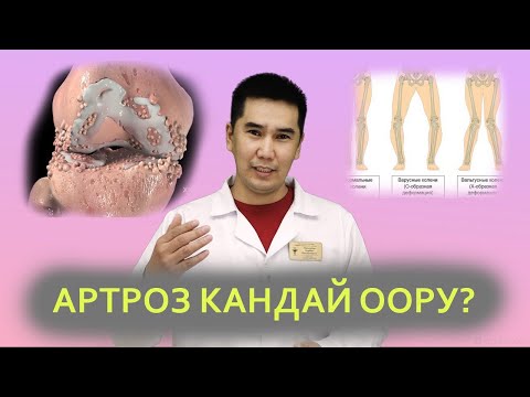 Видео: ТИЗЕ ООРУСУ КАНДАЙ БОЛОТ? Ортопед-травматолог Нурбек Рыскулов