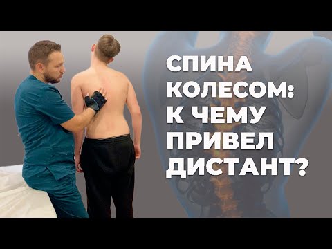 Видео: Спина колесом. К чему привел дистант | Костоправ  Матвеев Олег