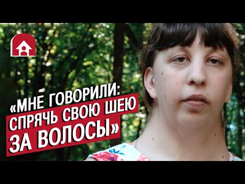 Видео: Девушка с синдромом Шерешевского-Тернера: Вика | Быть молодым