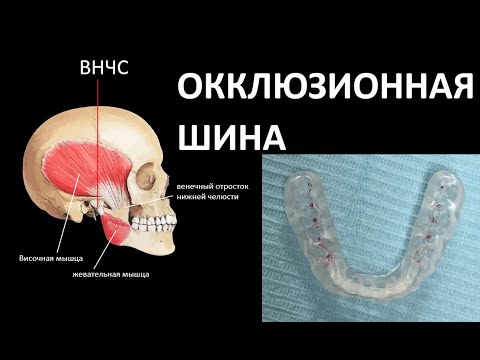 Видео: ОККЛЮЗИОННАЯ ШИНА