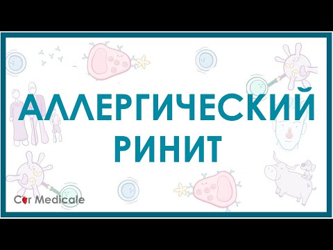 Видео: Аллергический ринит - причины, симптомы, лечение