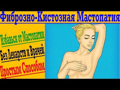 Видео: Мастопатия – как предотвратить и избавиться от Фиброзно - Кистозной болезни !
