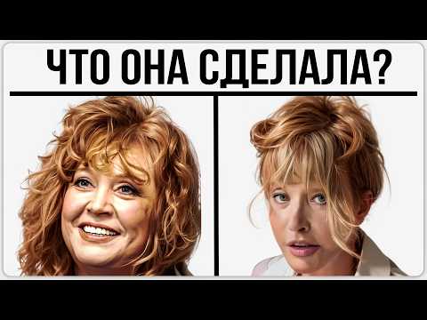 Видео: Почему Пугачева выглядит на 40, а ей 76? Вся правда от хирурга