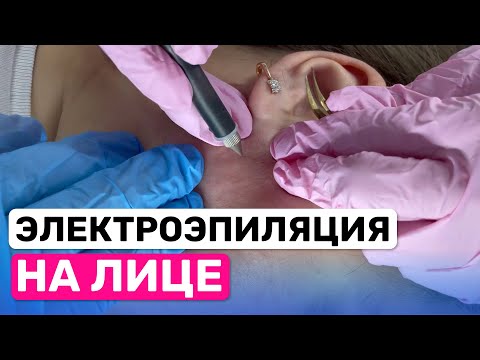 Видео: Урок №59. Волосы на бакенбардах: как безопасно удалить волосы на лице?