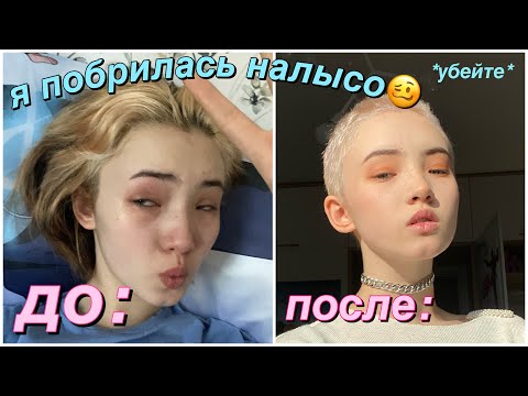 Видео: Я Побрилась Налысо (волосы ТОЧНО ПОКИНУЛИ ЧАТ)