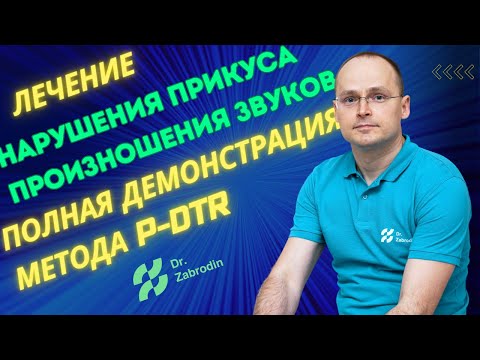 Видео: Именно поэтому у тебя неправильный прикус.Лечение методом P-DTR.