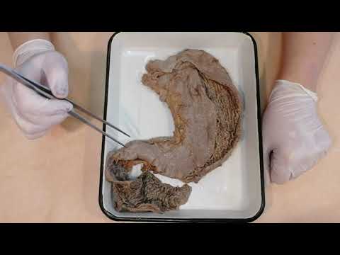 Видео: Пищевод, желудок