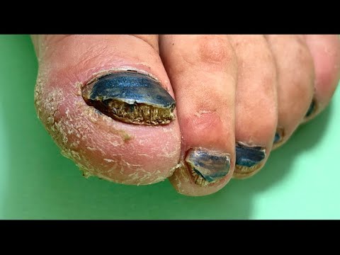 Видео: Скрывать😳 или исправлять, что делать? Педикюр