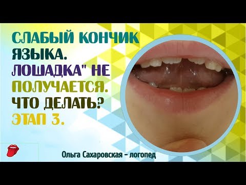 Видео: Паретическая форма дизартрии.  "Лошадка" не получается. Что делать? Этап 3