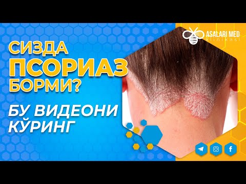 Видео: СИЗДА ПСОРИАЗ БОРМИ? ВИДЕОНГИ ОХИРИГАЧА КЎРИНГ. #saidatabiba  #asalarimed #psoriasis