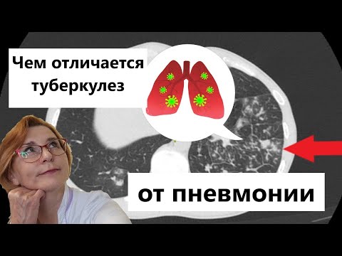 Видео: Туберкулез и пневмония