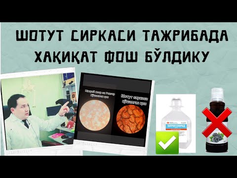 Видео: ШОТУТ СИРКАСИ ИСБОТДАН ЎТМАДИ ЭФИРДА ФОШ ҚИЛИНДИ/ ТРОМБНИ ЭРИТАОЛМАДИ / КИТОБГА КИРМАГАН