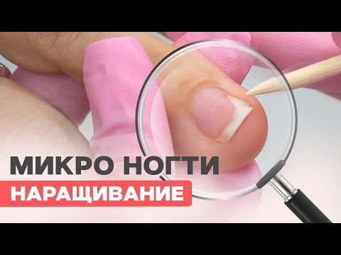 Видео: Наращивание на мини ногти трамплины | Онихолизис