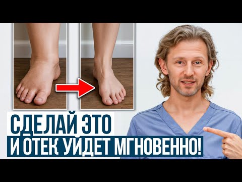 Видео: Твое тело КРИЧИТ о помощи! / Рассказываю, как избавиться от отеков раз и НАВСЕГДА!
