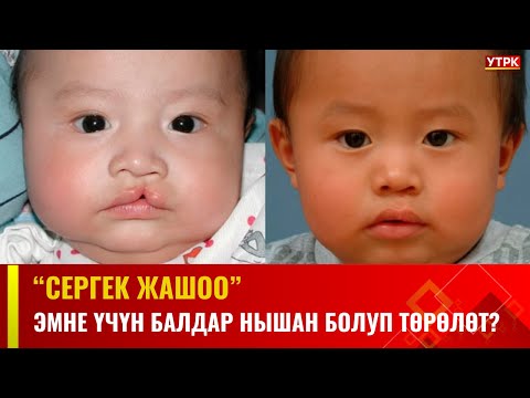 Видео: Эмне үчүн балдар нышан болуп төрөлөт? | СЕРГЕК ЖАШОО
