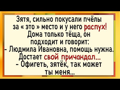 Видео: Как тёща увидела распухший у зятя! Сборник свежих анекдотов! Юмор!