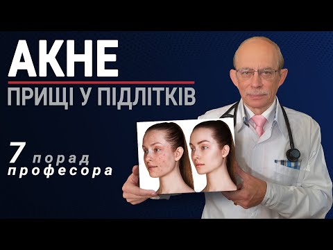 Видео: Акне прищі, вугрі на обличчі у підлітків - причини, лікування в домашніх умовах без антибіотиків