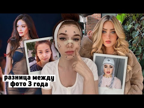 Видео: они сделали ПЛАСТИКУ ради ПОПУЛЯРНОСТИ