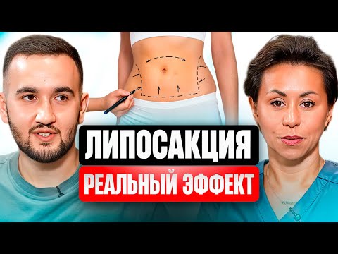 Видео: ЛИПОСАКЦИЯ: «ВОЛШЕБНОЕ ПОХУДЕНИЕ» или РИСК для ЗДОРОВЬЯ?! 