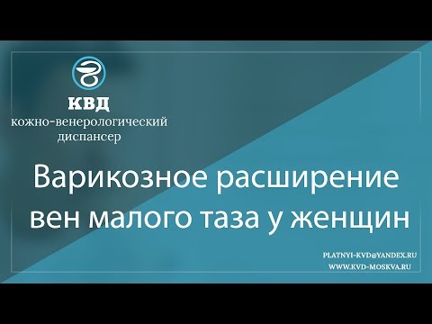 Видео: 984  Варикозное расширение вен малого таза у женщин