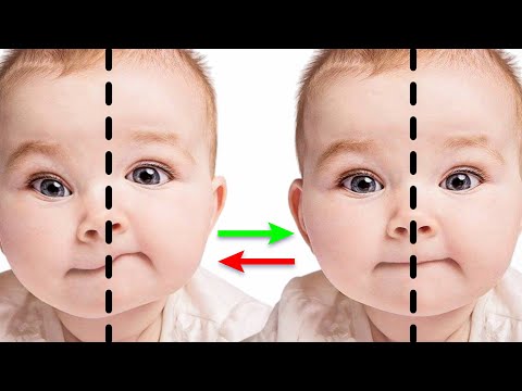 Видео: СДЕЛАЙ ЭТО ПОКА НЕ ПОЗДНО! Предотвращаем асимметрию лица и головы у младенца