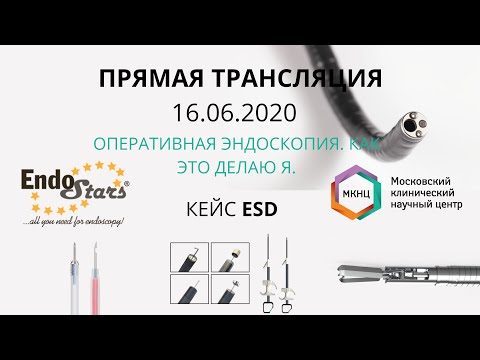 Видео: ESD,  "Оперативная эндоскопия. Как это делаю Я".