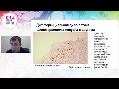 Видео: Опухоли желудка. Взгляд морфолога