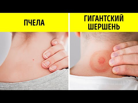 Видео: Факты о пчелах и насекомых, которые поразят ваш разум