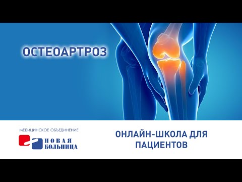 Видео: Остеоартроз
