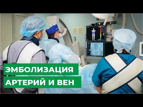 Видео: Эмболизация артерий и вен