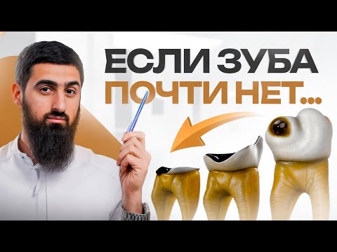 Видео: Можно ли нарастить зуб на корень? Лечение зубов