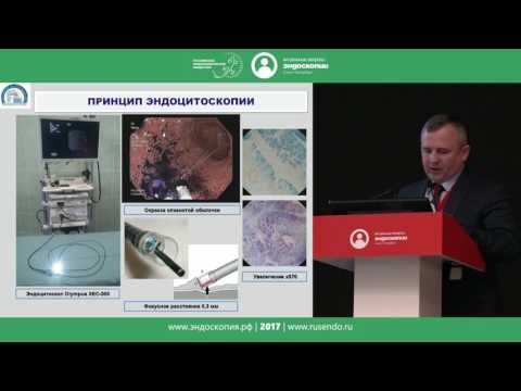Видео: Взгляд в будущее: эндомикроскопическое и эндоцитоскопическое исследование слизистой оболочки бронхов
