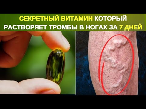 Видео: 💊🚨 СЕКРЕТНЫЙ ВИТАМИН, РАСТВОРЯЮЩИЙ КРОВЯНЫЕ СГУСТКИ В ВАШИХ НОГАХ 🦵💥