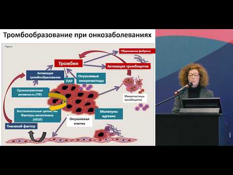 Видео: Тромбозы и антитромботическая терапия у онкологических больных