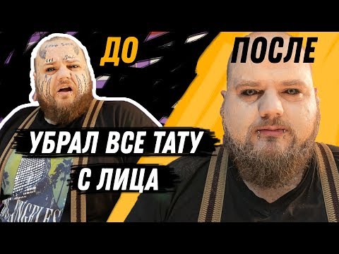 Видео: Убрал ТАТУ С ЛИЦА БЕЗ лазерного УДАЛЕНИЯ ! можно ли спрятать тату ТОНАЛКОЙ ?