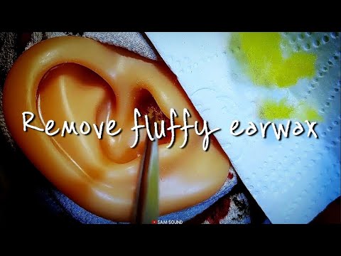 Видео: ASMR Пушистая ушная сера, заполняющая ваши уши Удаление ушной серы Очистка ушей No talking