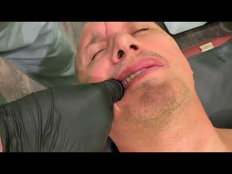 Видео: Коррекция челюсти. ВНЧС