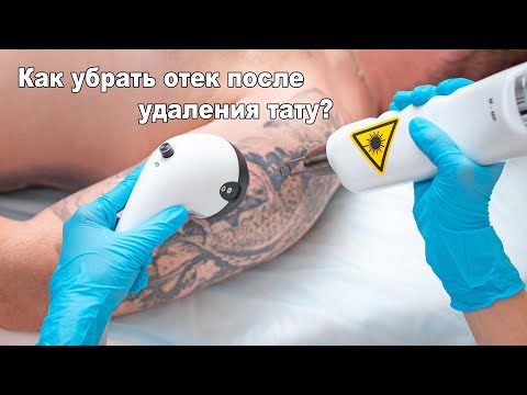 Видео: Как снять отек после удаления татуировки или перманентного макияжа. Демонстрация методик.