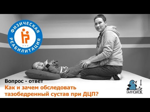 Видео: Как и зачем обследовать тазобедренный сустав при ДЦП?