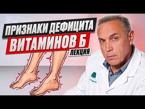 Видео: Скрытые признаки ДЕФИЦИТА ВИТАМИНОВ группы B, которые врачи часто НЕ ВИДЯТ